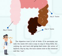 Incredibly, how dirty your intestinal tract is!